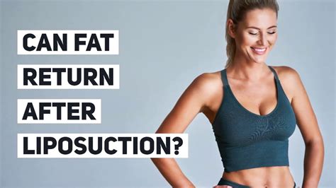 Can Fat Return After Liposuction My Ultimate Healthylife