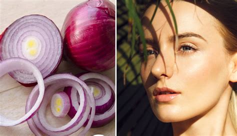5 DIY Ways To Use Onions For A Glowing Face Lifeberrys