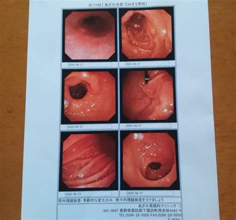 大腸内視鏡検査 あざみ胃腸科クリニック