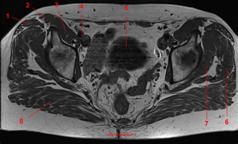 MRI Of The Hip Detailed Anatomy W Radiology
