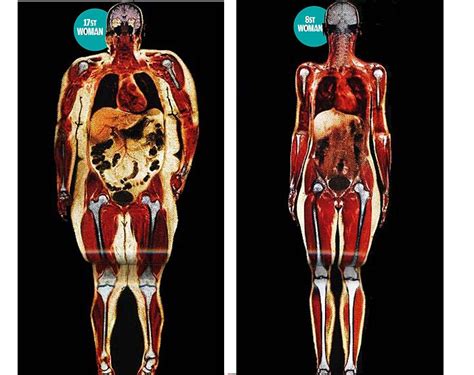 Your Bmi Is It Fat Or Muscle Surprising Pictures Your