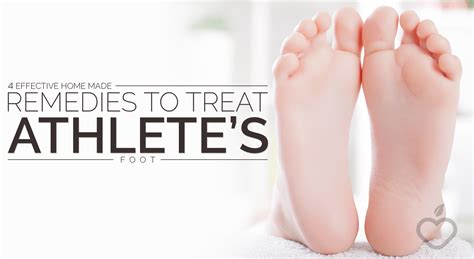 4 Effective Home Made Remedies To Treat Athletes Foot