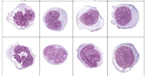 Monocyte Morphology And Maturation Cp Hematology Pinterest