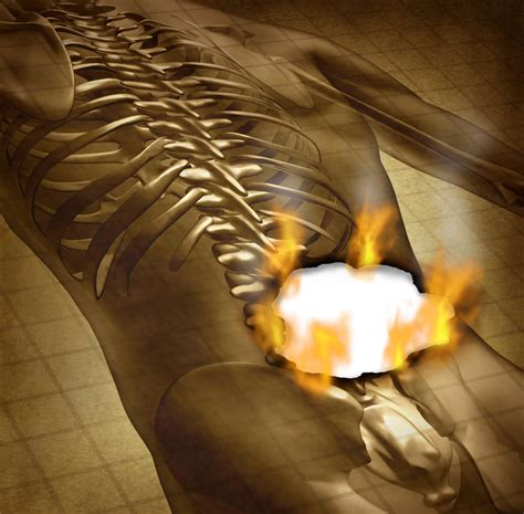 New Study Shows Benefits of Spinal Cord Stimulator Implants