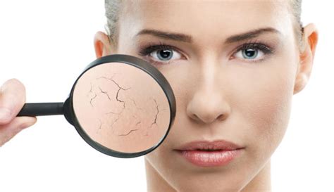 Sequedad En La Piel Tipos Y Tratamientos Skin Expert