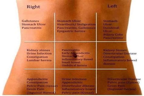 Abdominal Pain Map That Shows What Could Be The Cause Of Your Pain