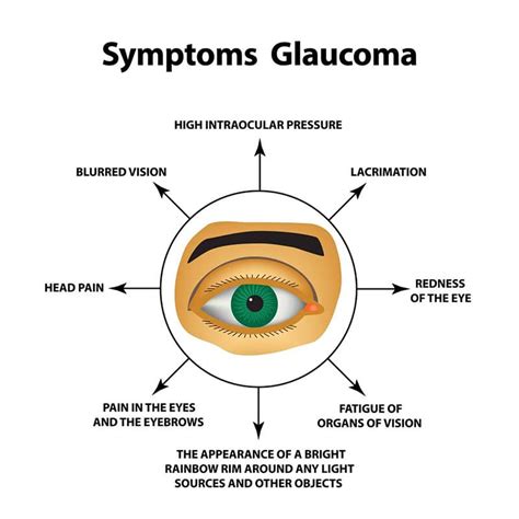 What Is Glaucoma Georgia Eye Clinic