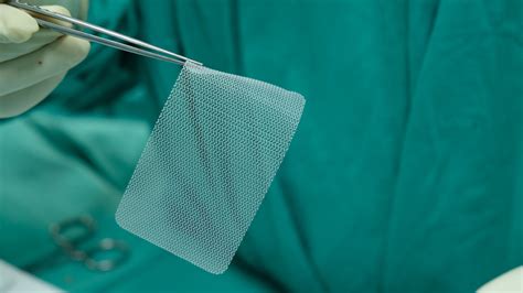 Hernias And Surgical Repair With Mesh Implants What Should You Know