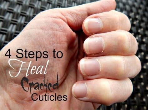 4 Steps To Heal Cracked Cuticles Simple Life Mom