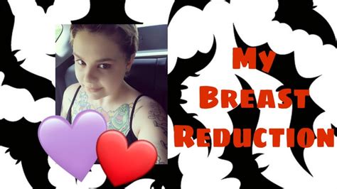 My Breast Reduction Pre Op 3 Weeks Post My Experience So Far Youtube
