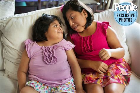 Formerly Conjoined Twins Teresa And Josie Turn 21 Inside Their