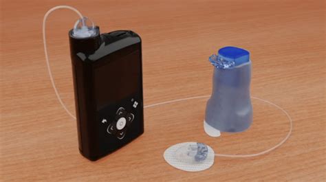 Fda Approves Medtronic Diabetes New 7 Day Wear Infusion Set