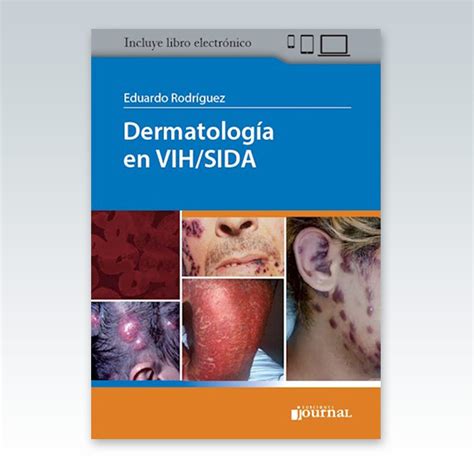 Dermatología En Vihsida 1ª Edición 2021 Edimeinter