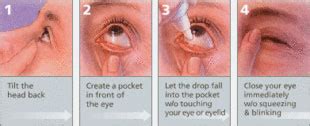 This syndrome normally arises when we fail to wink our eyelids and stare at the computer so far, there are no side effects of using it but i would recommend following certain steps to make the experience even better. How to Use Eye Drops | Dry Eye Seattle | Northwest Eye ...
