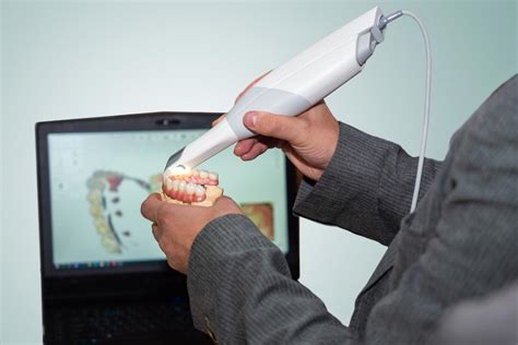 Intra Oral Scanner Bolingbrook Il Suburban Oral Surgery And