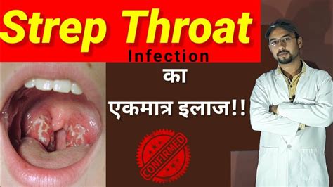 Throat Infection Treatment Throat Pain Sore Throat Treatment