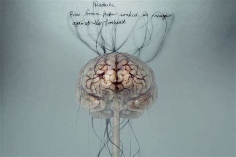 Brain Anatomy Wallpaper Anatomical Artistic Image