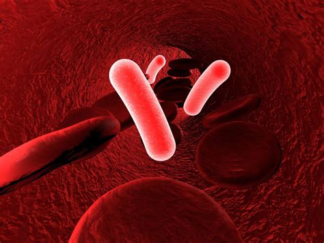 Mandell, douglas, and bennett's principles and practice of infectious. Sepsis: Blutvergiftung ist eine vielfache Todesursache bei ...