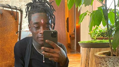 Lil Uzi Vert Removes 24 Million Diamond From Forehead Consequence