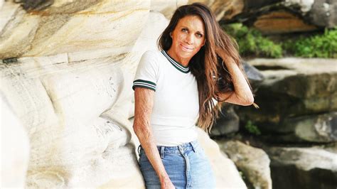 Turia Pitt Reveals She Owed ATO After Making Massive GST Mistake The Cairns Post