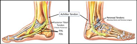 Ankle Tendon Tear Centeno Schultz Clinic