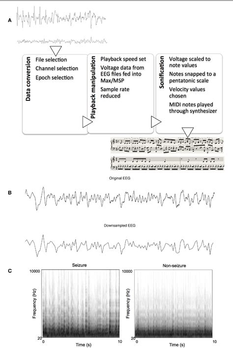 Figure 1 From Rapidly Learned Identification Of Epileptic Seizures From