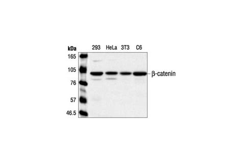 Catenin Antibody Cell Signaling Technology