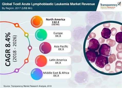 T Cell Acute Lymphoblastic Leukemia Market Share Analysis And Research Report By 2026 Whatech