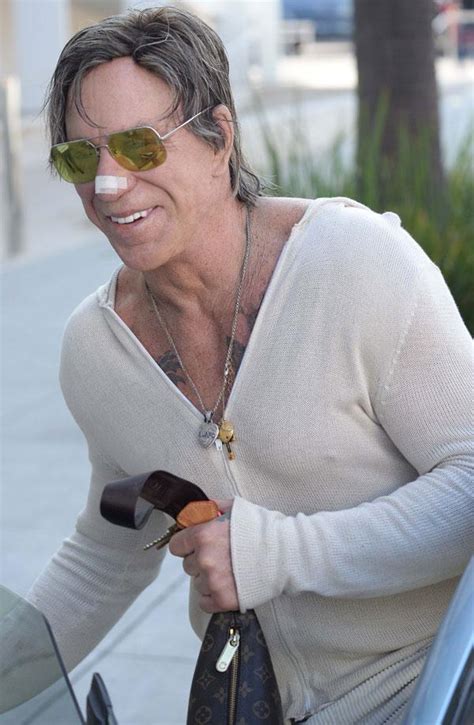 More Time Under The Knife For Mickey Rourke Sports Bandaged Nose In 8