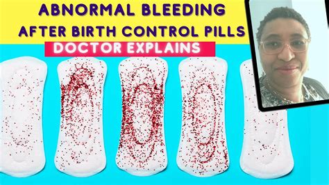 Abnormal Bleeding After Birth Control Pills Contraception Side