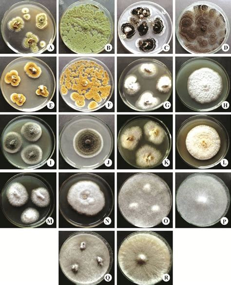 Re Isolated Colony And Pure Culture Plates Of The Pathogenic Fungi