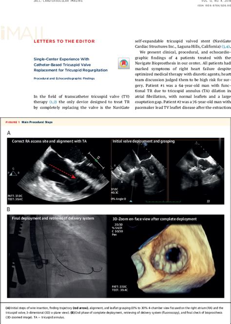 Single Center Experience With Catheter Based Tricuspid Valve