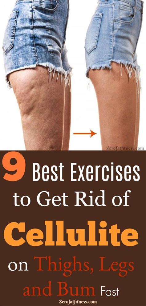 List Of How To Get Rid Of Cellulite On Back Of Legs Fast Ideas