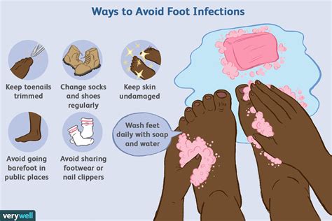 How To Identify And Treat Common Foot Infections 2022
