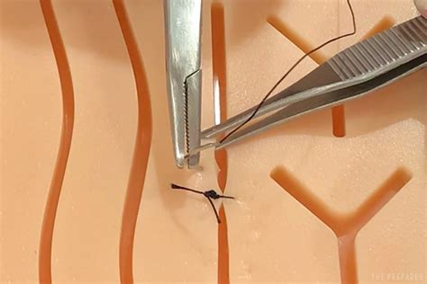 How To Suture Or Close A Wound The Prepared