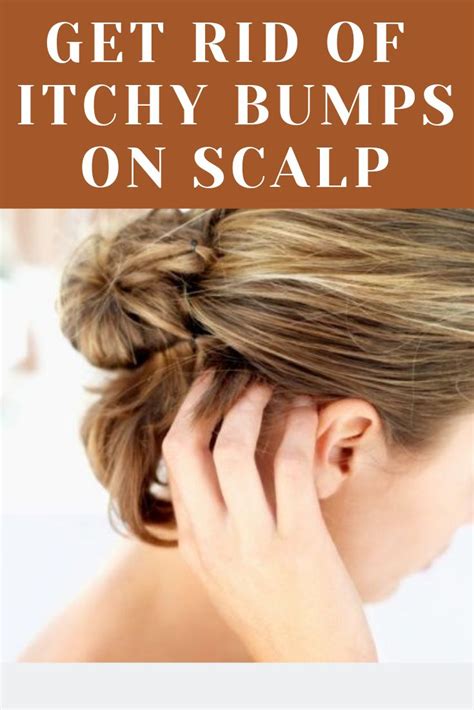 Scalp Bumps Treatment