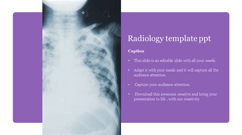 Add To Cart Radiology Template Ppt Presentation Design