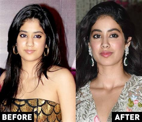 6 Before And After Pictures Of Celebrities Who Actually Looked Good