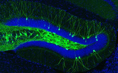 Engram Cells In The Hippocampus Of An Ad Mouse Image Eurekalert