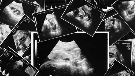 China Cracks Down On Surrogate Births Even As Infertility Rises