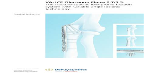 Va Lcp Olecranon Plates 2735 The Fracture Specific Low Mobile