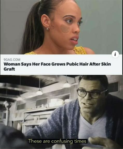 woman says her face grows pubic hair after skin graft these are confusing times ifunny