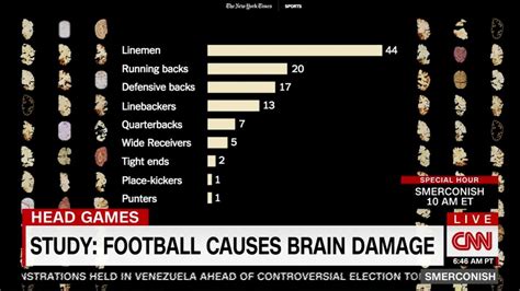 Still, based on earlier reports of brain damage, the researchers had expected to find some signs of dementia in these football neurology a research field that studies the anatomy and function of the brain and nerves. Study: Football causes brain damage - CNN Video