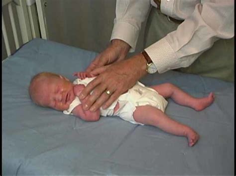 Neurologic Exam Pediatric Newborn Abnormal Tone Arm Recoil