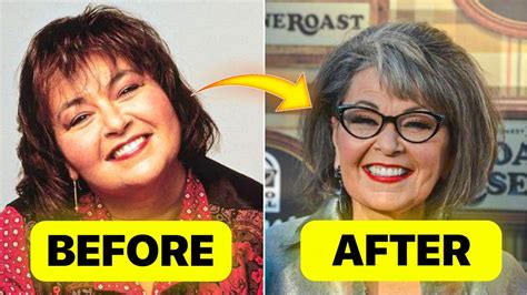 The Truth Behind 69 Year Old Comedian Roseanne Barrs Incredible Weight Loss Transformation