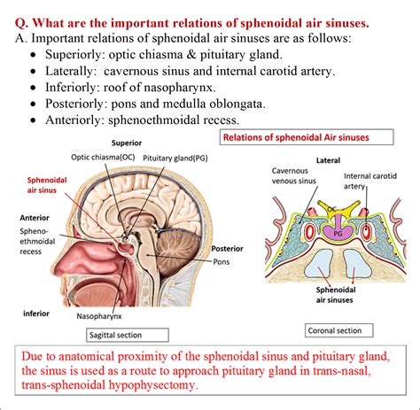Diagram Back Of Head Sinus Diagram Mydiagramonline
