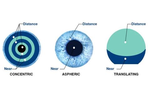 how do multifocal contact lenses work and are they right for you