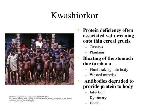 Ppt Malnutrition Powerpoint Presentation Id791012