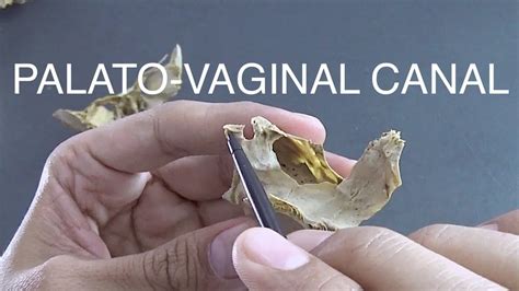 Palato Vaginal Canal Youtube