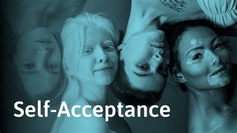 Self Acceptance Definition Exercises And Why Its So Hard